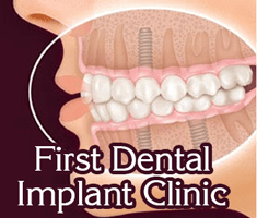 Slider image (1) First Dental Implant Clinic